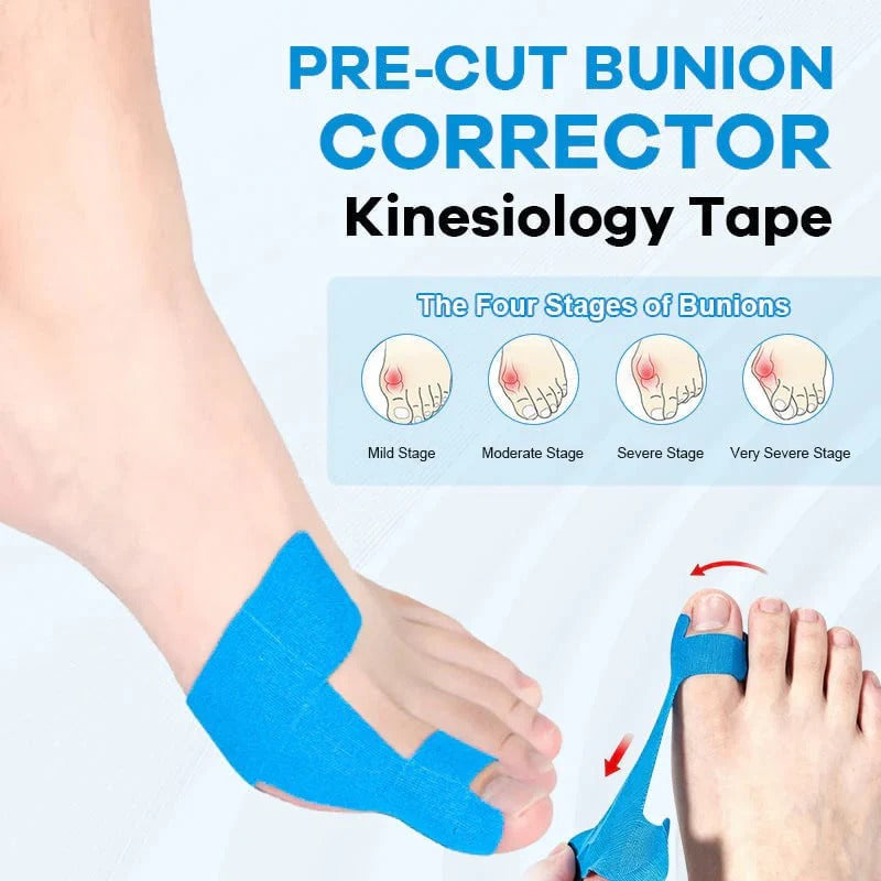 π₯Buy 1 Get 1 Freeπ₯Adjustable Bunion Relief Toe Corrector Wrap