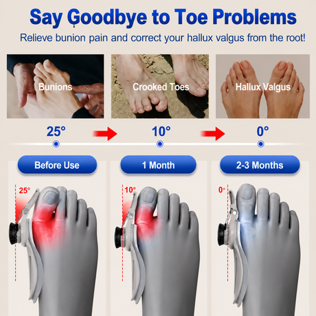 Prova & Co Adjustable Bunion Corrector