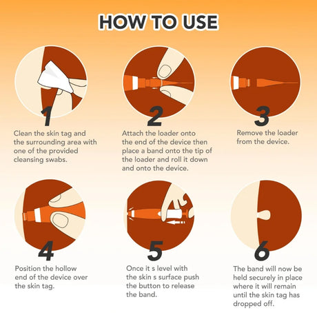 Step by step instructions on how to use ClearSkin Pro Skin Tag Remover pen for safe at-home skin tag treatment
