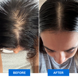 Scalp Bliss Enhancer