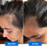 Scalp Bliss Enhancer