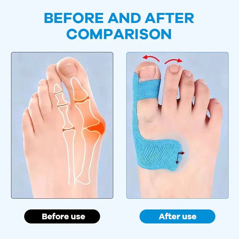 🔥Buy 1 Get 1 Free🔥Adjustable Bunion Relief Toe Corrector Wrap