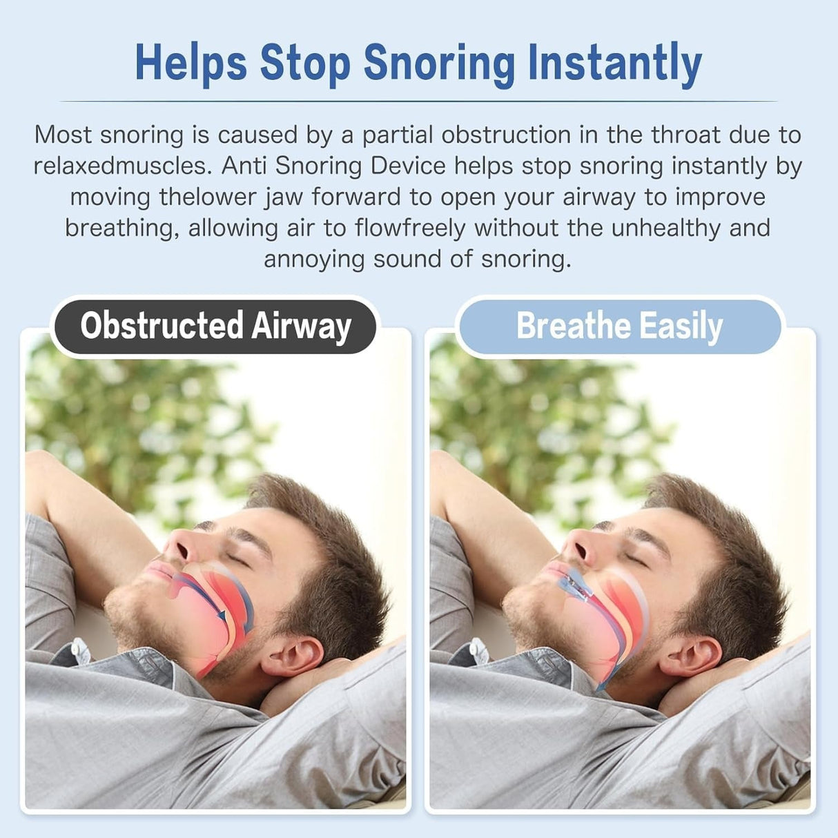 Anti-Snore Pro Mouthpiece – Custom Jaw Support for Peaceful Sleep