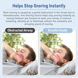Anti-Snore Pro Mouthpiece – Custom Jaw Support for Peaceful Sleep