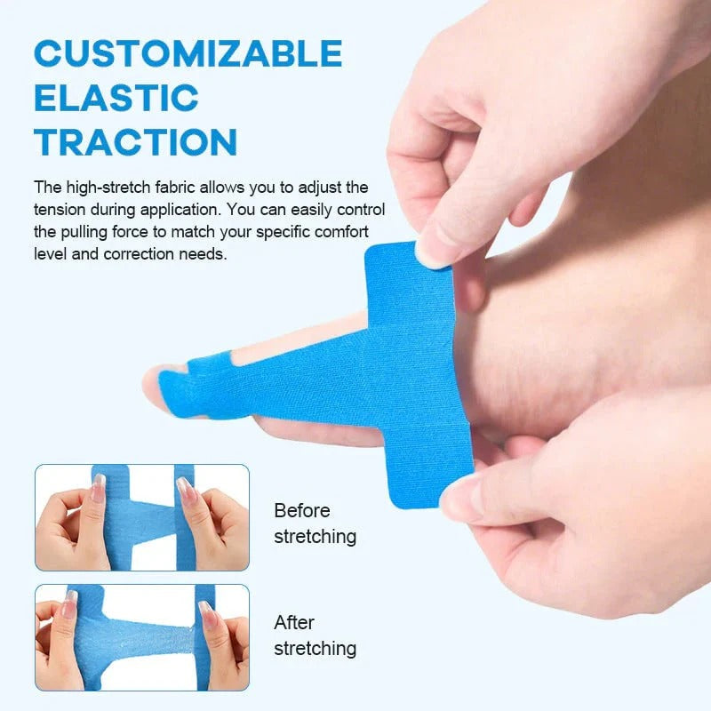 🔥Buy 1 Get 1 Free🔥Adjustable Bunion Relief Toe Corrector Wrap